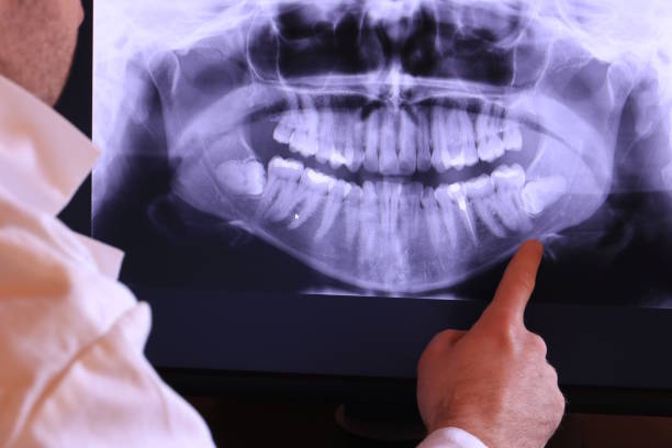 Best Emergency Dental Care for Sports Injuries in Orwigsburg, PA