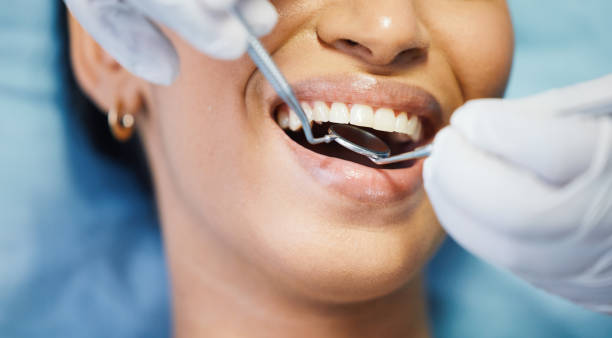 Best Emergency Denture Repair in Orwigsburg, PA